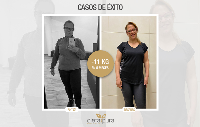 CASO DE ÉXITO, TERESA CARLINHOS